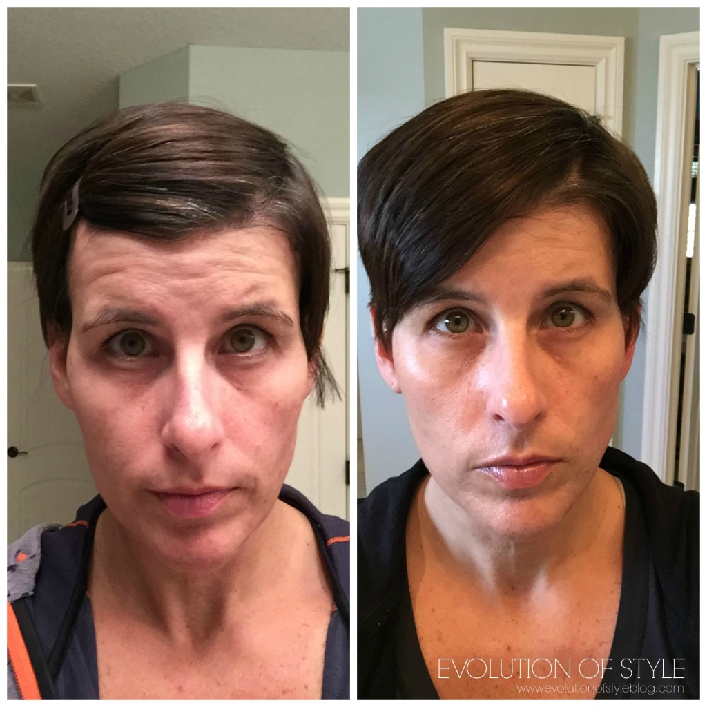 Rodan+Fields Before and After Photos