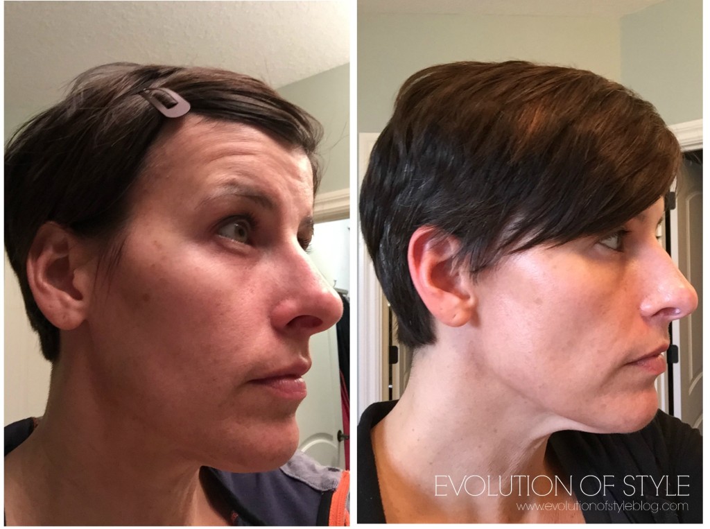 Rodan+Fields before and after photos